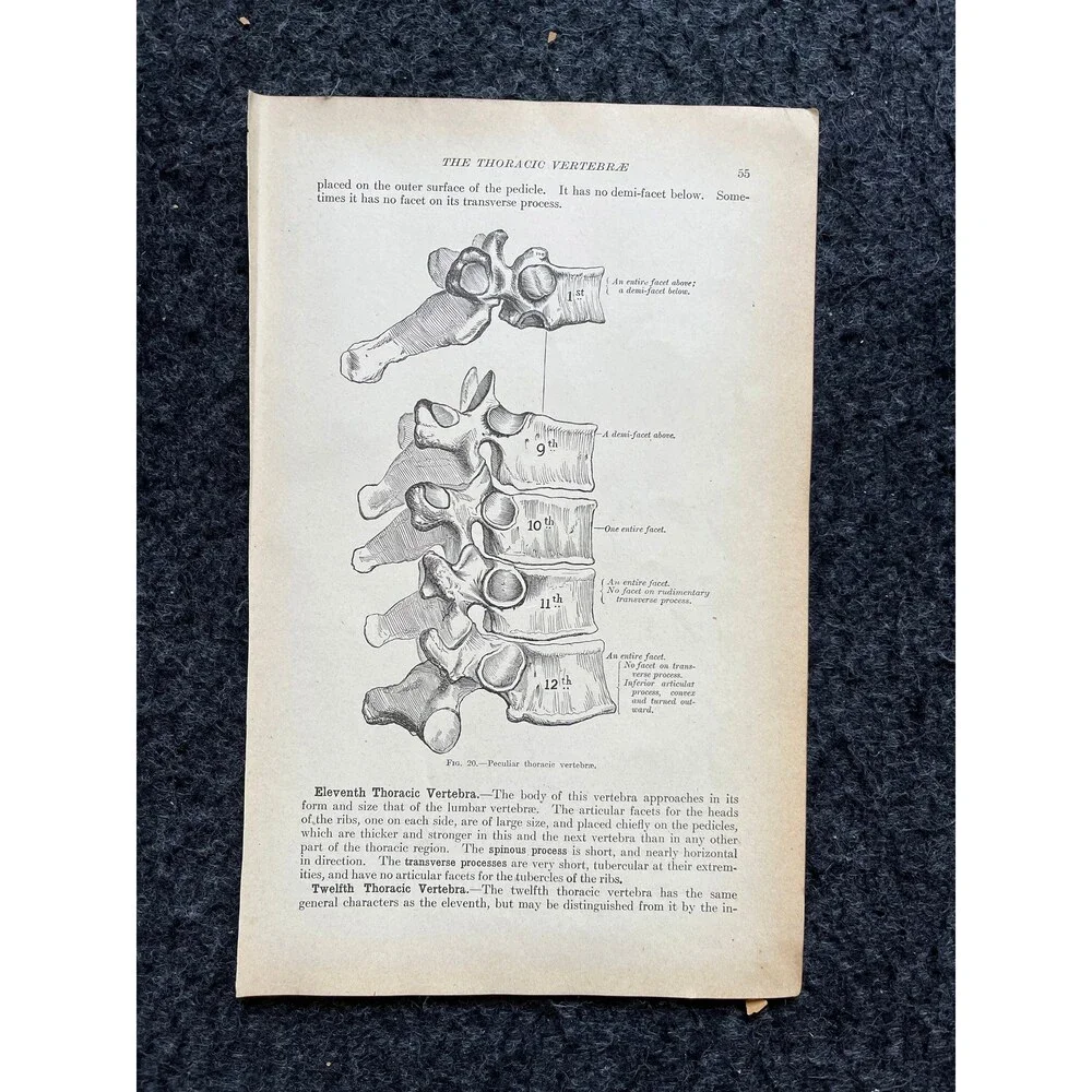 Original 1913 Anatomy Pages of Human Body, Anatomy Physiology Textbook Gifts, T